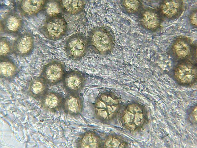 Tuber aestivum dalla fotografia alla microscopia